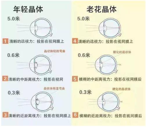 近視就不會(huì )老花了嗎？